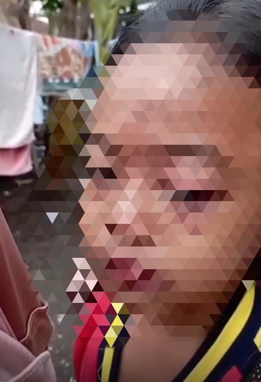 Potongan layar yang merekam bocah SD menjadi korban kekerasan dengan disiram kuah bakso panas oleh tantenya sendiri. (Istimewa)