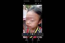 Bocah Perempuan yang Disiram Tante Sendiri Dititipkan karena Orang Tua Berpisah 8 Bocah Perempuan yang Disiram Tante Sendiri Dititipkan karena Orang Tua Berpisah